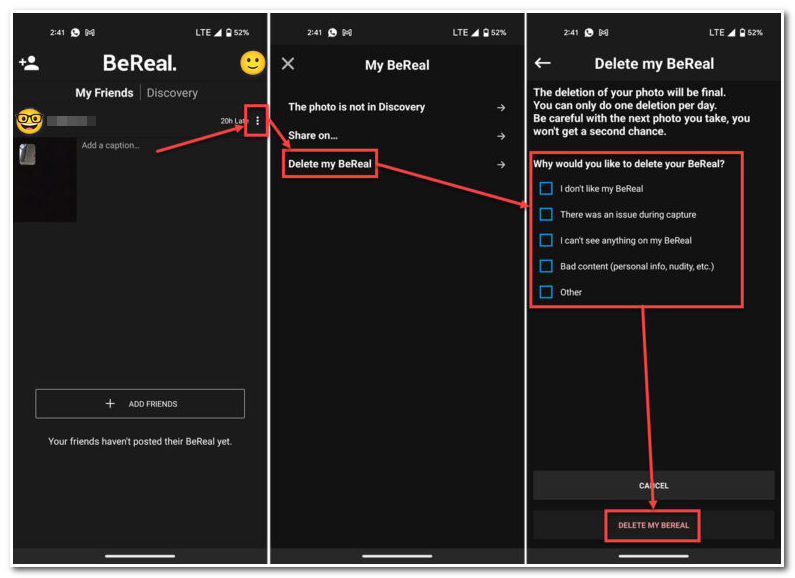 BeReal 포스트 안드로이드 삭제